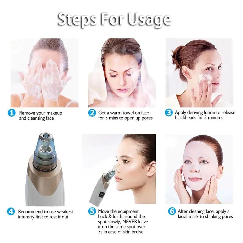 5 in 1 Multifunction Blackhead Removal Rechargeable Machine