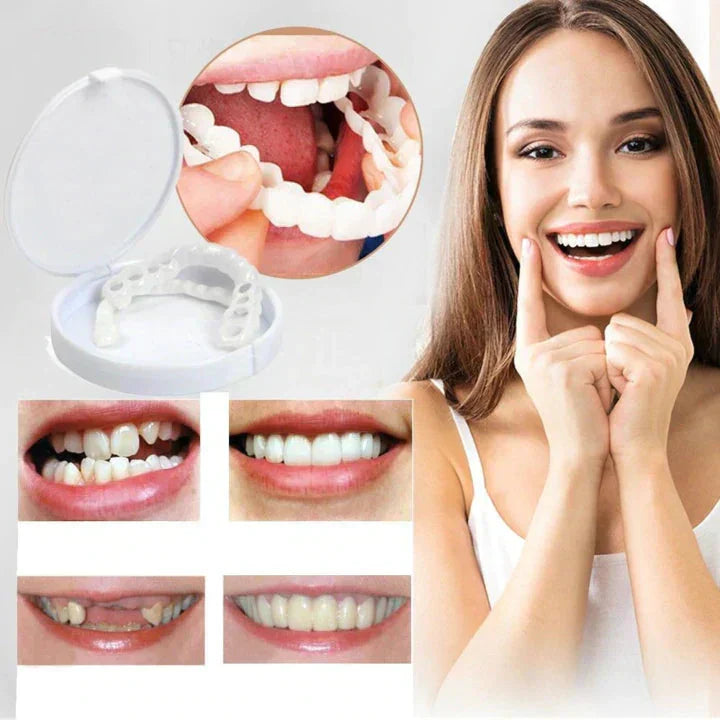 Snap on smile